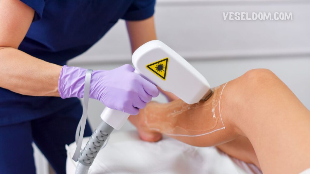 Come viene eseguita la depilazione laser